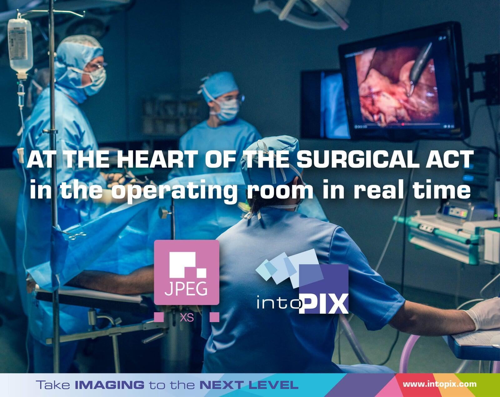 JPEG XS는 IP 네트워크를 통해 실시간 비디오를 지원함으로 수술실에서 수술 행위의 중심에 있습니다!